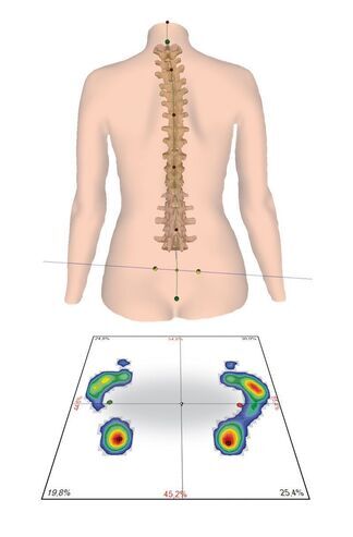 Druckmessung - Fachzentrum für Orthopädie Technik Tretin GmbH